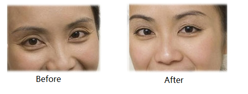 1546659614758184.png 1.png